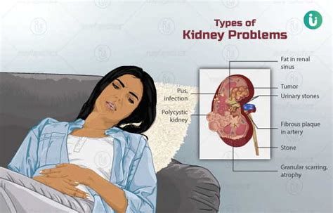 Kidney Diseases: symptoms, causes, treatment, medicine, prevention, diagnosis