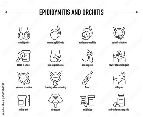 Epididymitis and Orchitis, symptoms, diagnostic and treatment vector ...