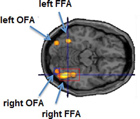 Fusiform Face Area Diagram