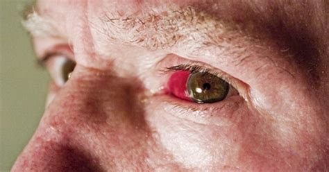 Cómo reducir los ojos rojos | eHow en Español
