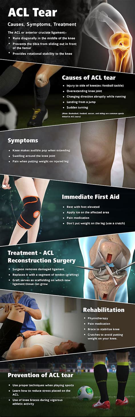 Acl Tear Symptoms