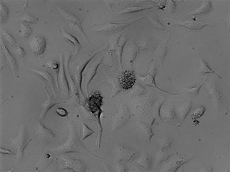 Contamination on a cell culture - Biochemistry and Molecular Biology ...