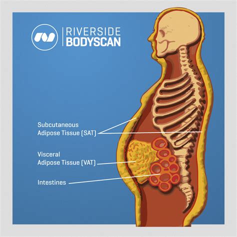 Visceral Fat: What Is It And How It Drives Up Inflammation, 58% OFF