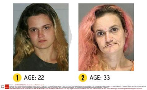 Before and after pics of crystal meth users are enough to put you off ...