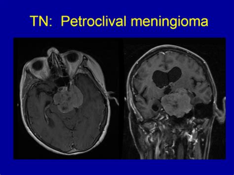 Diagnostic Evaluation - Valley Neurosurgical Institute