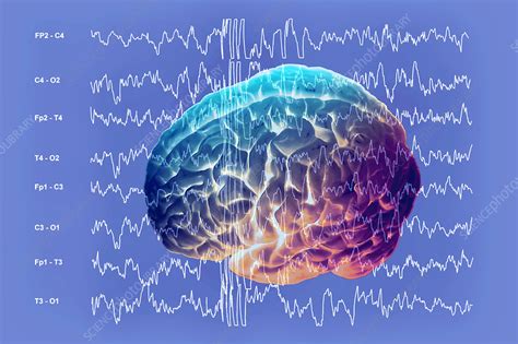 Brain and brain waves in epilepsy - Stock Image - M150/0279 - Science Photo Library