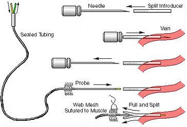 BASi® | Vascular Microdialysis