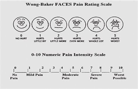 Printable Pain Scale With Faces