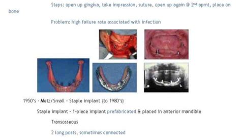 Are the sizes for o rings for dental implants color coded - Dental News ...