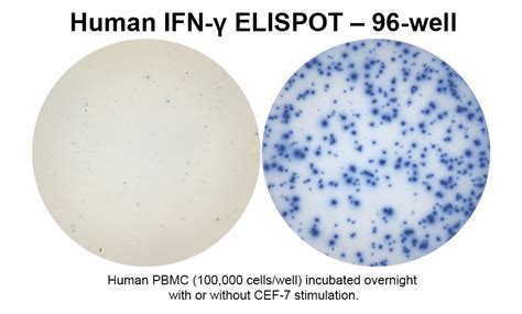 Human IFN-γ Single-Color ELISPOT | ImmunoSpot®