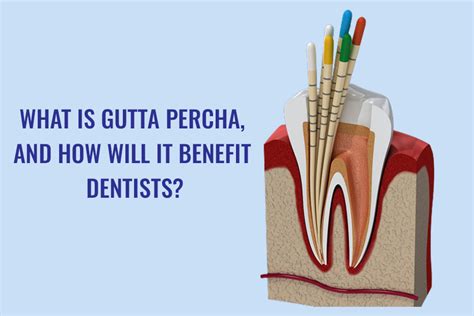 What is Gutta Percha, and how will it benefit dentists? – Dental Avenue