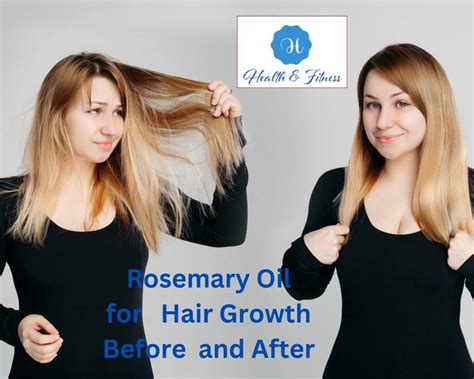 Rosemary Oil For Hair Growth Before And After: A Detailed Exploration