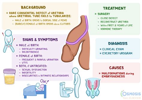 Epispadias: What Is It, Causes, and More | Osmosis