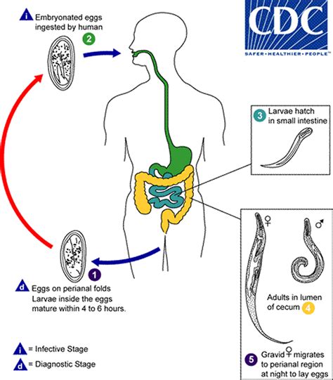 Pinworm Infection - Symptoms, Anus, Diagnosis, Treatment