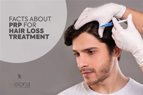 15 Unique facts about PRP for Hair Loss treatment