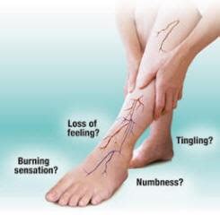 Peripheral Neuropathy Treatment Brisbane | Walk Without Pain