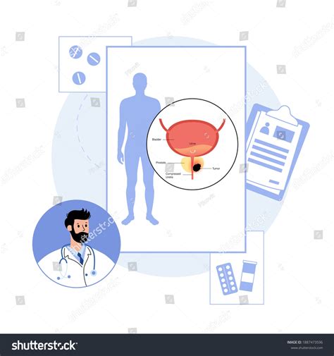 Prostate Cancer Vector Doctor Consults Set Stock Vector (Royalty Free ...