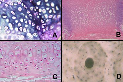 A= elastic, B= fibrocartilage, C=hyaline, D= bone | Nursing school ...