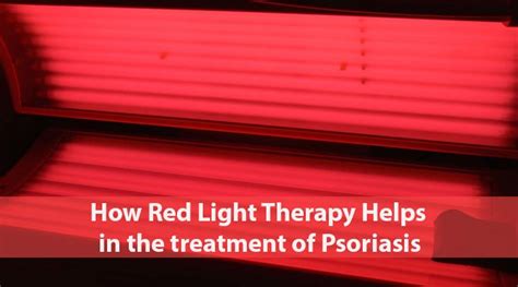 Red Light Therapy For Psoriasis