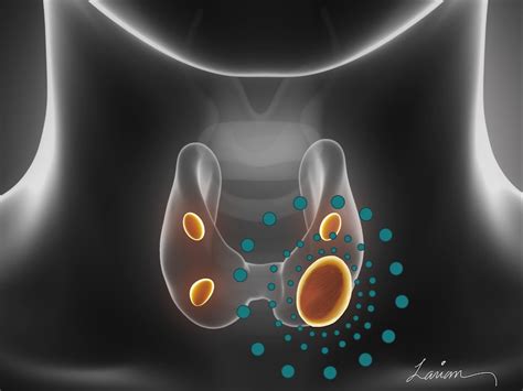 Hyperparathyroidism Causes & Treatment Options | Dr. Babak Larian