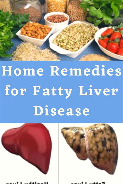 Home Remedies for Fatty Liver Disease