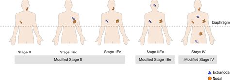 Frontiers Modified Stage Grouping Of Diffuse Large B-Cell, 50% OFF