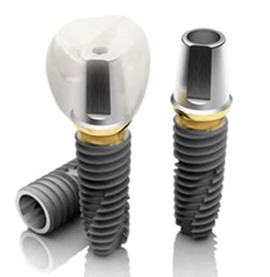 Platform Switching for Dental Implants | Hiossen® Implant