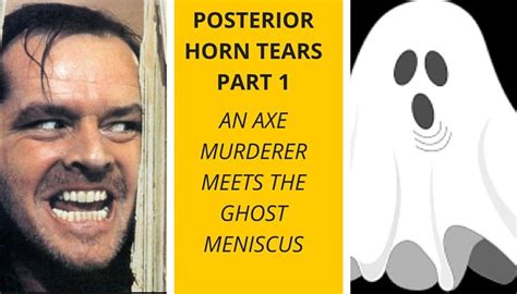 Meniscus Posterior Horn Part 1: An axe murderer meets the ghost meniscus - Radedasia