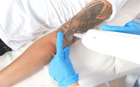 Tattoo Removal Creams: A Guide for Beginners | LaserAll