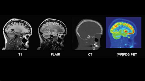 How Much Is A Dog Mri Scan Uk