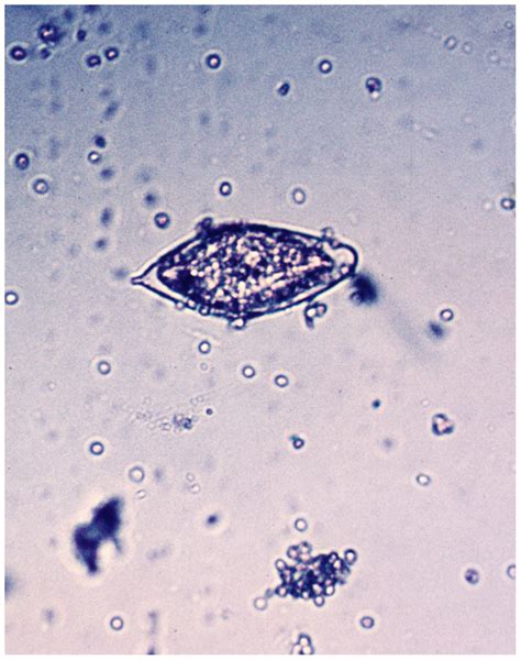 S. haematobium ovum as seen in urine microscopy. | Download Scientific Diagram