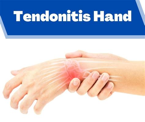 Tendonitis Hand Treatment in Pune Archives - The Prolotherapy Clinic