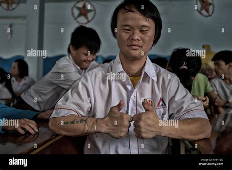 Agent orange victim vietnam hi-res stock photography and images - Alamy