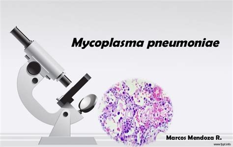 Laboratory diagnosis, Treatment and Prevention of Mycoplasma pneumoniae