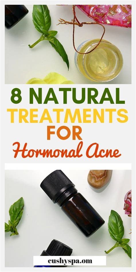 Hormonal Imbalance Acne Treatment