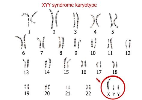 Y Chromosome - The Definitive Guide | Biology Dictionary