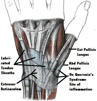 Wrist Extensor Retinaculum Injury