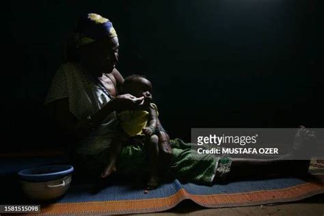 128 Obstetric Fistula Stock Photos, High-Res Pictures, and Images ...