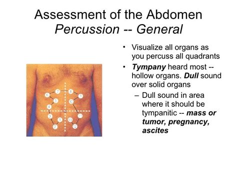 Acute Abdomen