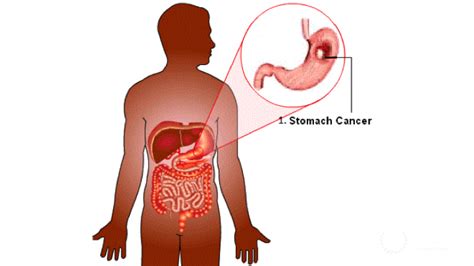 General Surgery Operations and Procedures