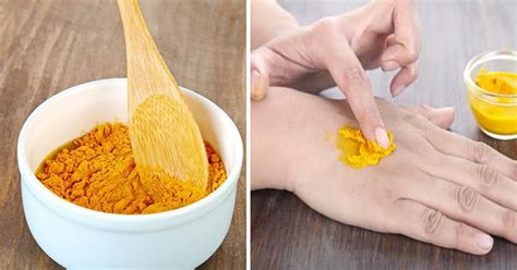 7 Home Remedies for Skin Fungus That Actually Work - Small Joys