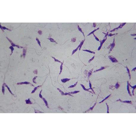 Leishmania Donovani- Habitat, Morphology And Life Cycle, 50% OFF