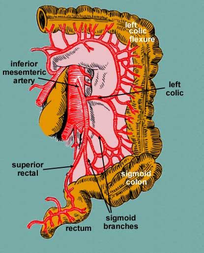 Inferior Mesenteric Artery (IMA) - Stepwards