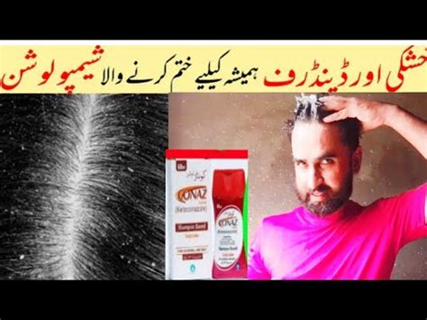 conaz shampoo benefits in urdu | conaz lotion shampoo based - YouTube