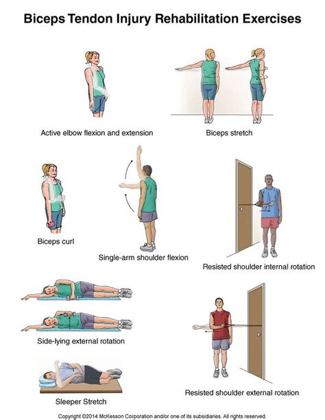 Summit Medical Group | Bicep tendonitis, Rehabilitation exercises ...