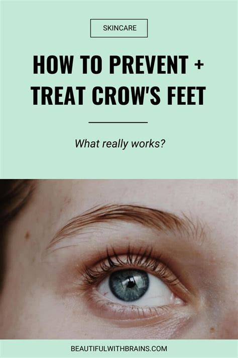 Crow's Feet: How To Prevent And Treat Them – Beautiful With Brains