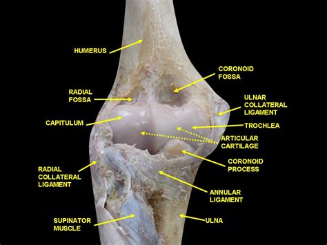 File:Elbow joint - deep dissection (anterior view, human cadaver).jpg - Wikimedia Commons