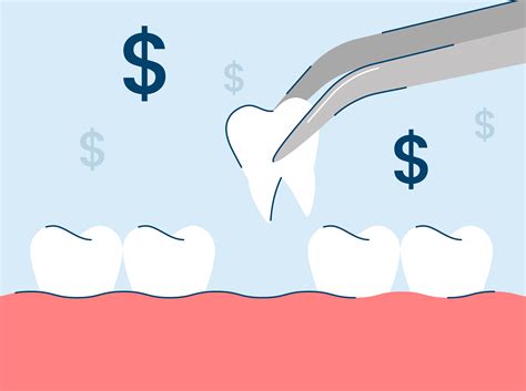 How Much Does A Tooth Extraction Cost?