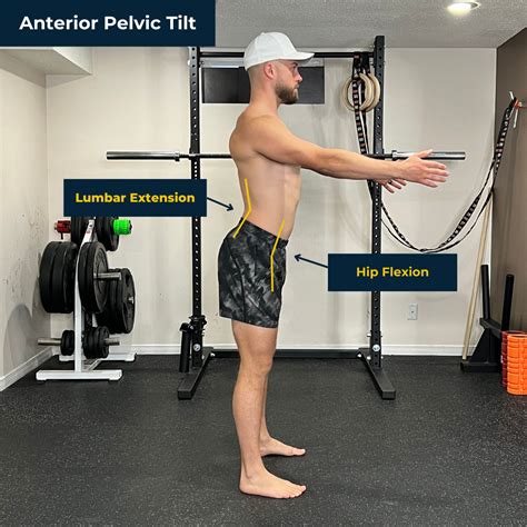 How Anterior Pelvic Tilt Influences Your Squat Depth