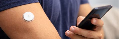 Are We All Going to Wear a Continuous Glucose Monitor? | Vital Health